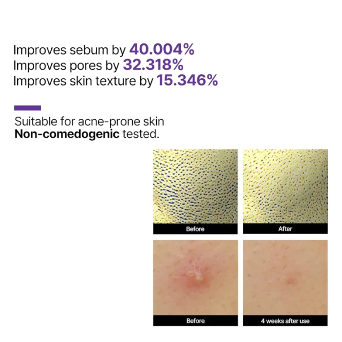 SOME BY MI Retinol Intense Reactivating Serum 30ml - Image 6