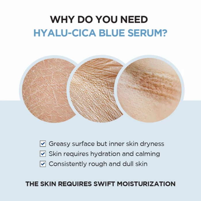 SKIN1004 Centella Hyalu-Cica Blue Serum 50ml - Image 2
